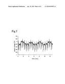 Pressure-sensitive conductive yarn and biological information-measuring garment diagram and image