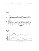 Pressure-sensitive conductive yarn and biological information-measuring garment diagram and image