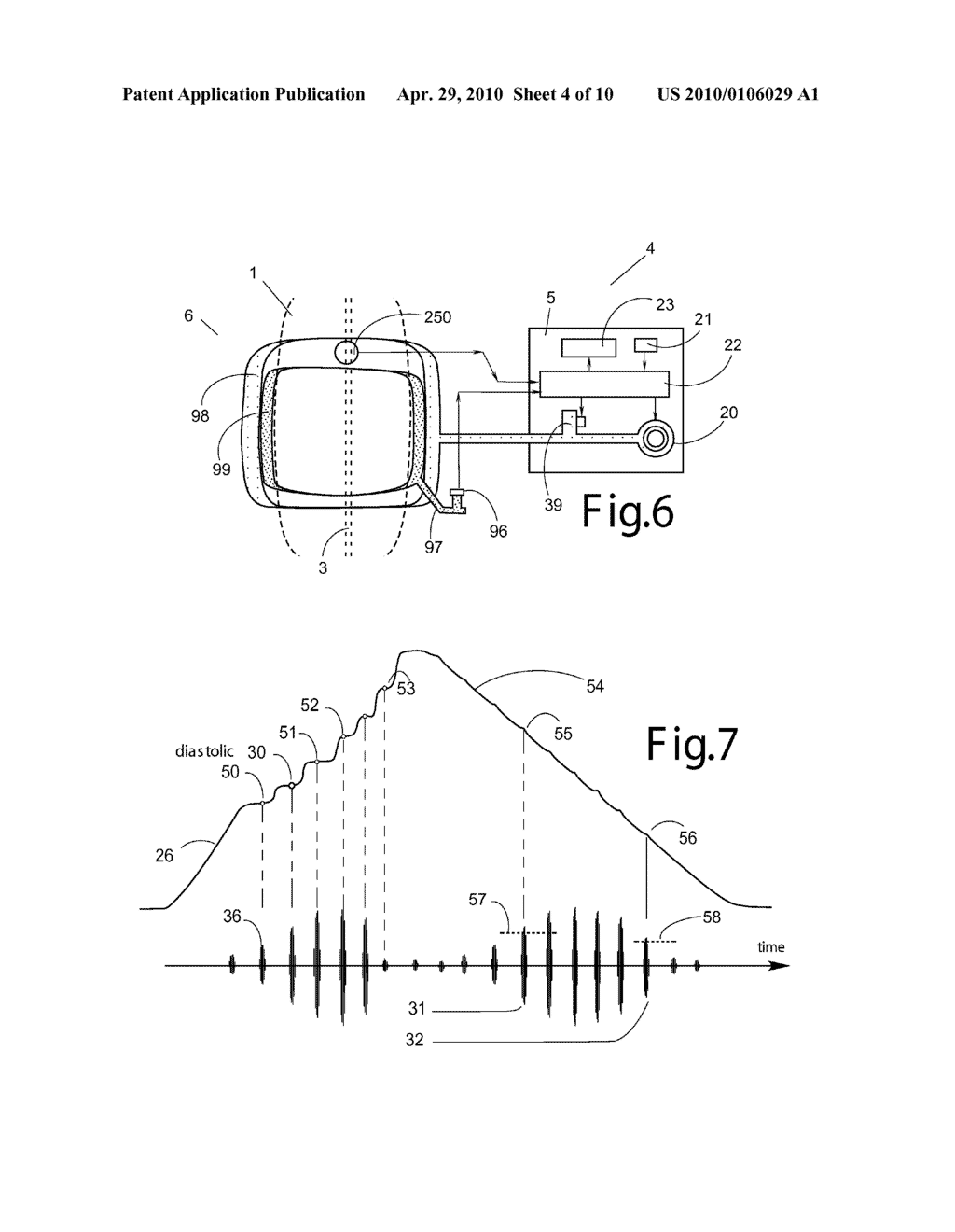 ARTERIAL BLOOD PRESSURE MONITOR WITH A LIQUID FILLED CUFF - diagram, schematic, and image 05