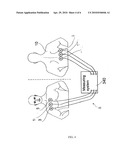 DEVICE AND METHOD FOR PREDICTING AND PREVENTING PULMONARY EDEMA AND MANAGEMENT OF TREATMENT THEREOF diagram and image