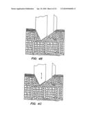 BLOOD AND INTERSTITIAL FLUID SAMPLING DEVICE diagram and image