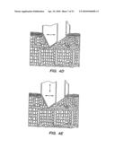 BLOOD AND INTERSTITIAL FLUID SAMPLING DEVICE diagram and image