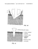 BLOOD AND INTERSTITIAL FLUID SAMPLING DEVICE diagram and image