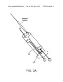 APPARATUS AND METHOD FOR TREATING SPIDER VEINS diagram and image