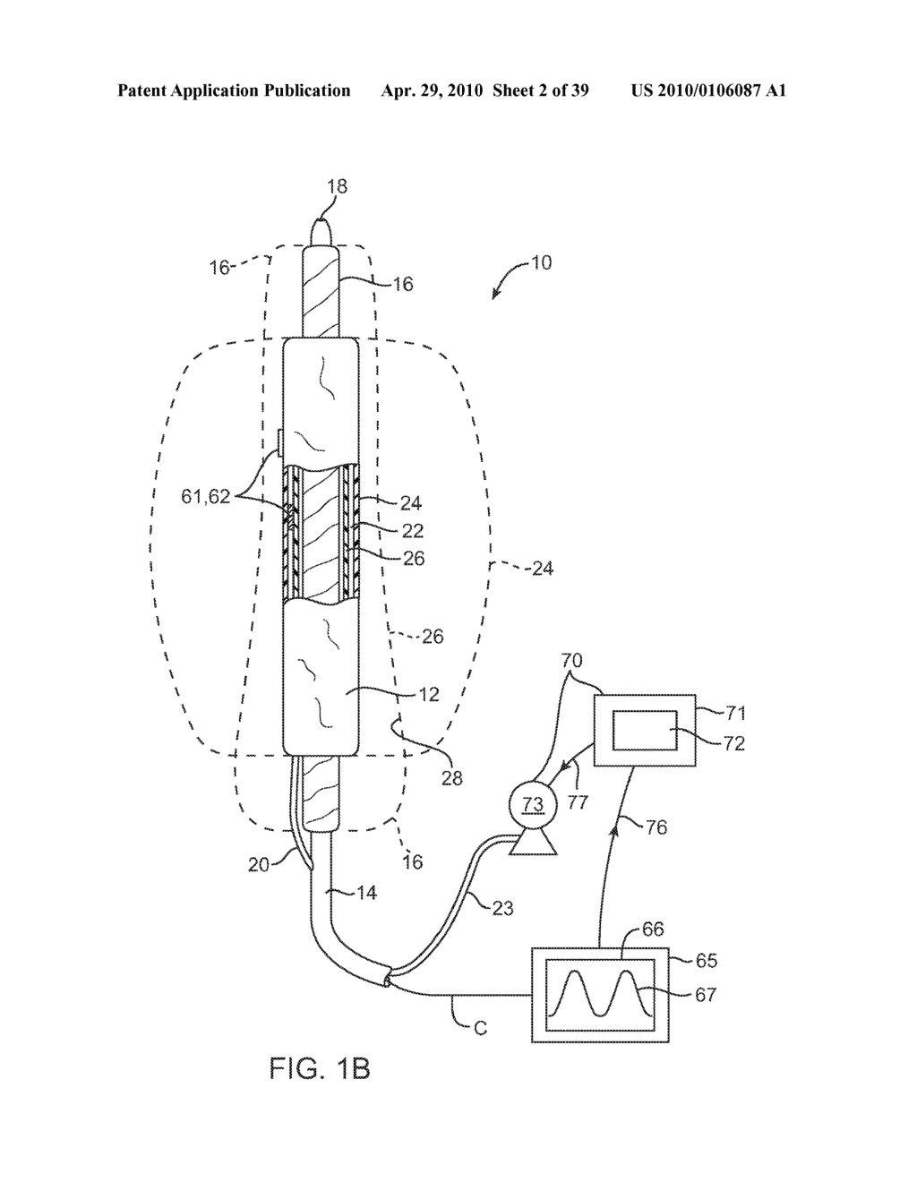 SYSTEM AND METHODS FOR ENDOVASCULAR ANEURYSM TREATMENT - diagram, schematic, and image 03