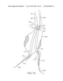 SYSTEM AND METHODS FOR ENDOVASCULAR ANEURYSM TREATMENT diagram and image