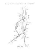 SYSTEM AND METHODS FOR ENDOVASCULAR ANEURYSM TREATMENT diagram and image