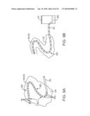 SYSTEM AND METHODS FOR ENDOVASCULAR ANEURYSM TREATMENT diagram and image