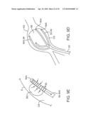 SYSTEM AND METHODS FOR ENDOVASCULAR ANEURYSM TREATMENT diagram and image