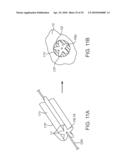 SYSTEM AND METHODS FOR ENDOVASCULAR ANEURYSM TREATMENT diagram and image