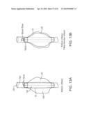 SYSTEM AND METHODS FOR ENDOVASCULAR ANEURYSM TREATMENT diagram and image