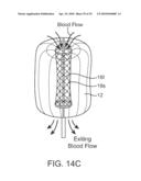 SYSTEM AND METHODS FOR ENDOVASCULAR ANEURYSM TREATMENT diagram and image