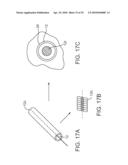 SYSTEM AND METHODS FOR ENDOVASCULAR ANEURYSM TREATMENT diagram and image