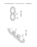 SYSTEM AND METHODS FOR ENDOVASCULAR ANEURYSM TREATMENT diagram and image