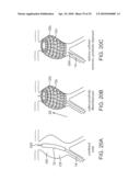 SYSTEM AND METHODS FOR ENDOVASCULAR ANEURYSM TREATMENT diagram and image