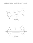 SYSTEM AND METHODS FOR ENDOVASCULAR ANEURYSM TREATMENT diagram and image