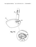 PORTABLE INFUSION PUMP WITH CANNULA INSERTER AND PAIN REDUCTION MECHANISM diagram and image