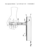 PORTABLE INFUSION PUMP WITH CANNULA INSERTER AND PAIN REDUCTION MECHANISM diagram and image