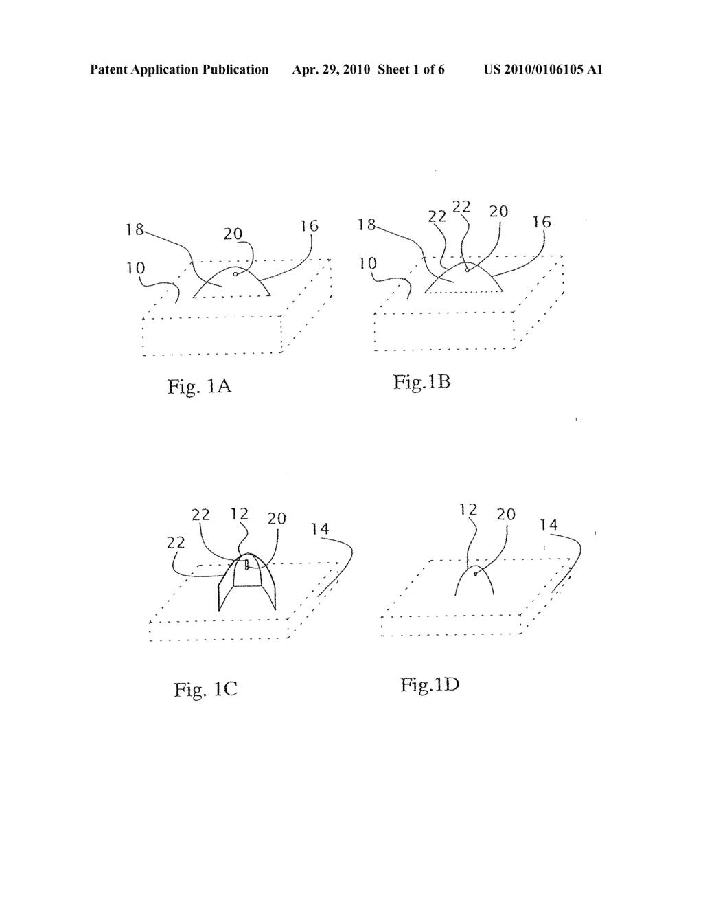 Microneedle Structure And Production Method Therefor - diagram, schematic, and image 02