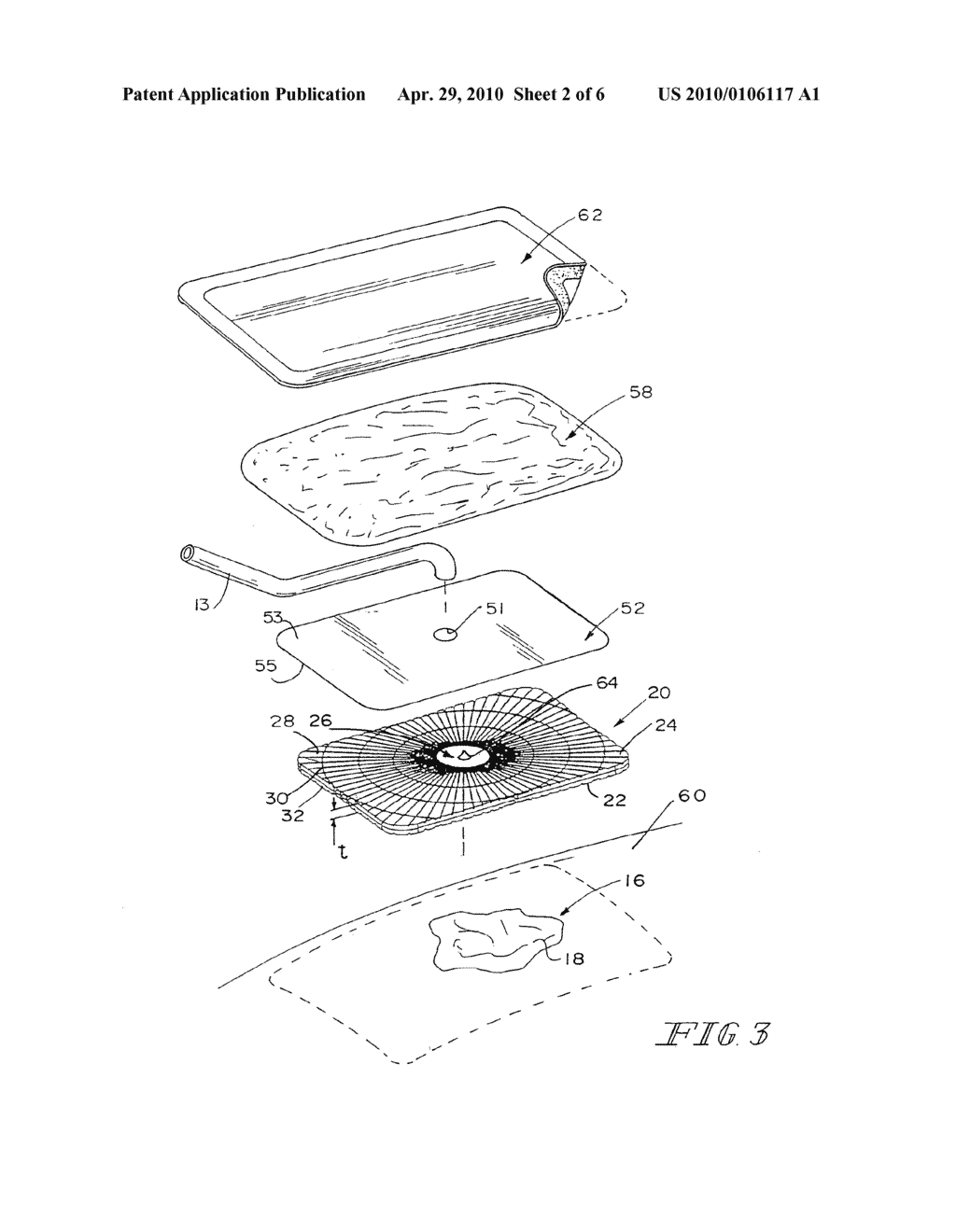 VACUUM THERAPY AND CLEANSING DRESSING FOR WOUNDS - diagram, schematic, and image 03