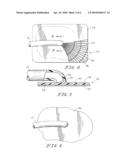 VACUUM THERAPY AND CLEANSING DRESSING FOR WOUNDS diagram and image