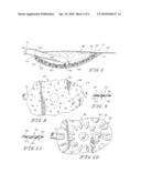 VACUUM THERAPY AND CLEANSING DRESSING FOR WOUNDS diagram and image