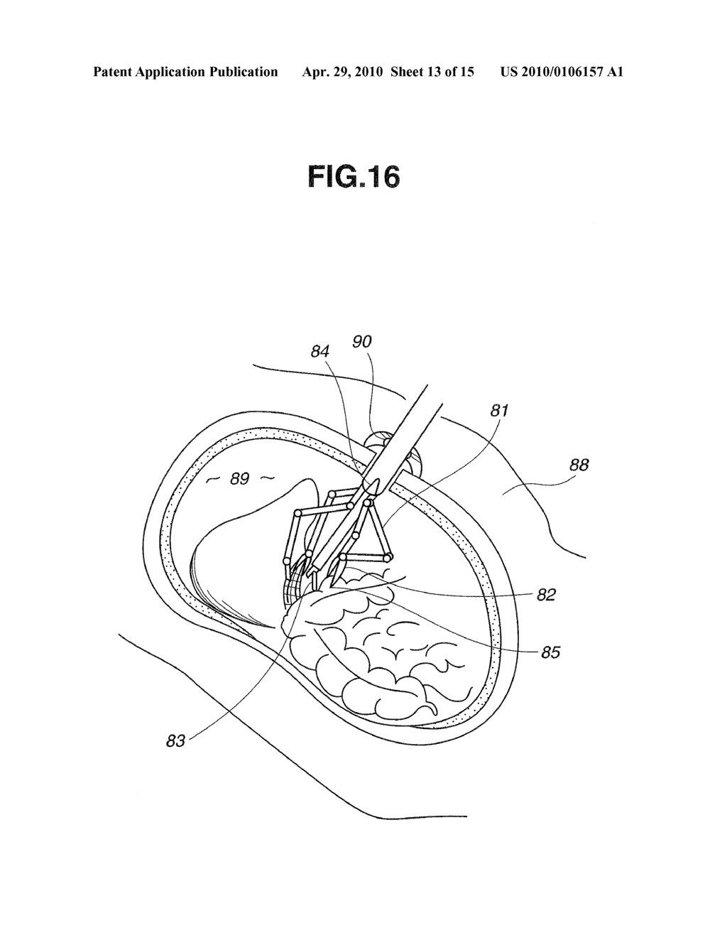 MEDICAL MANIPULATION APPARATUS - diagram, schematic, and image 14