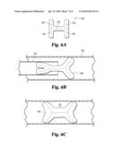 VASCULAR PLUGS diagram and image