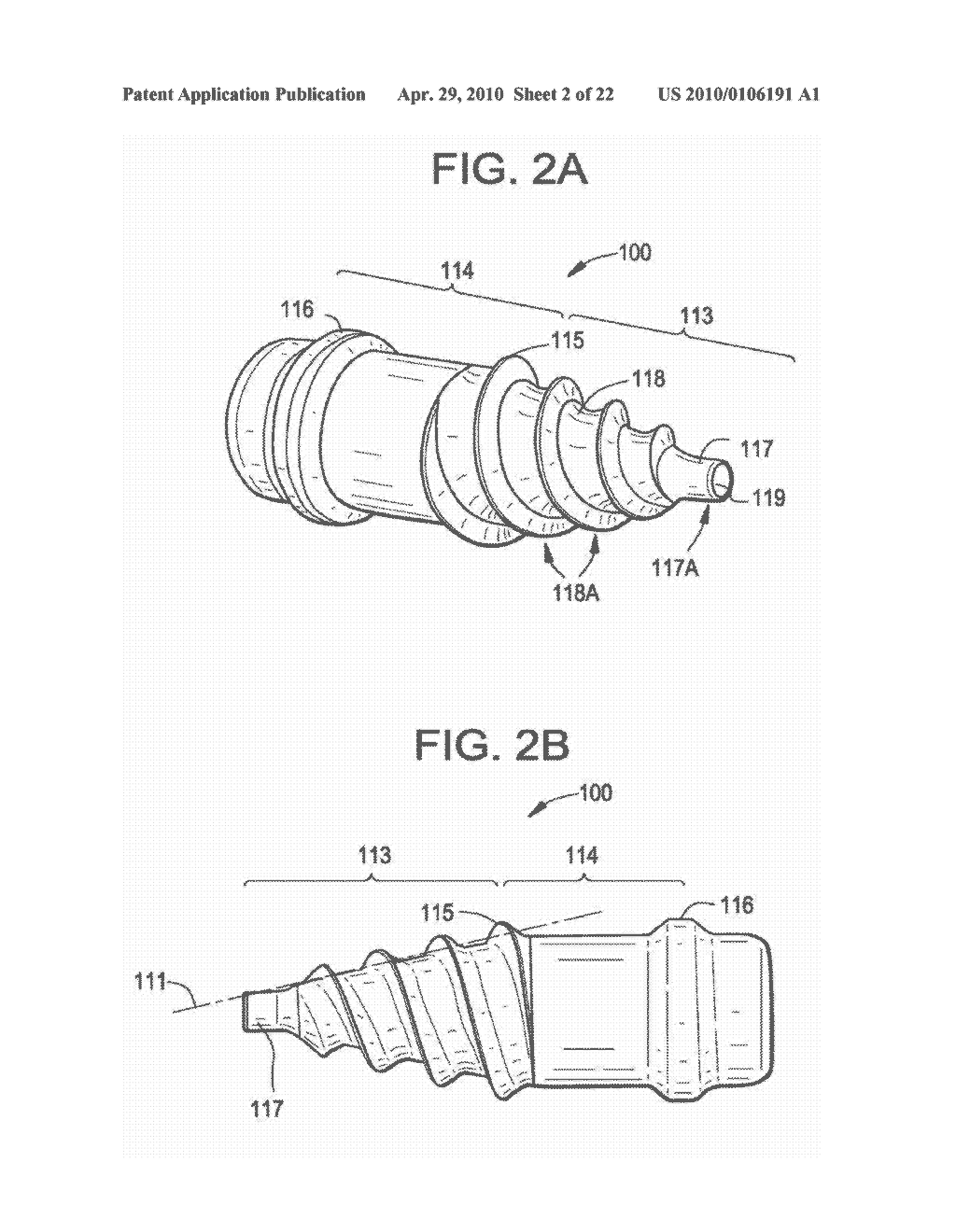 CONICAL INTERSPINOUS APPARATUS AND A METHOD OF PERFORMING INTERSPINOUS DISTRACTION - diagram, schematic, and image 03