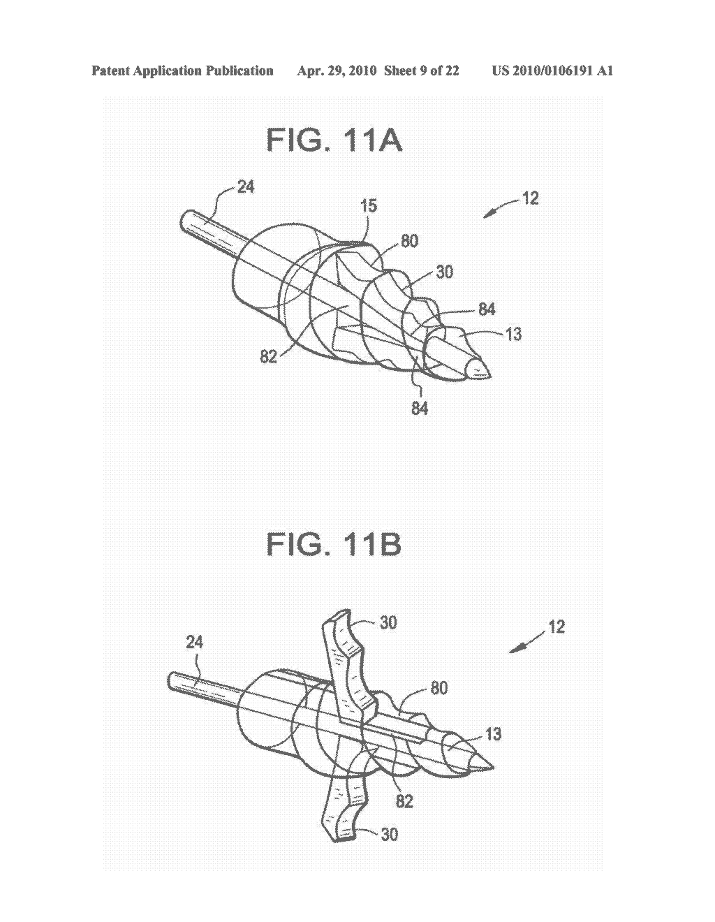 CONICAL INTERSPINOUS APPARATUS AND A METHOD OF PERFORMING INTERSPINOUS DISTRACTION - diagram, schematic, and image 10