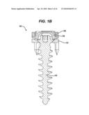 LOW PROFILE SPINAL TETHERING METHODS diagram and image