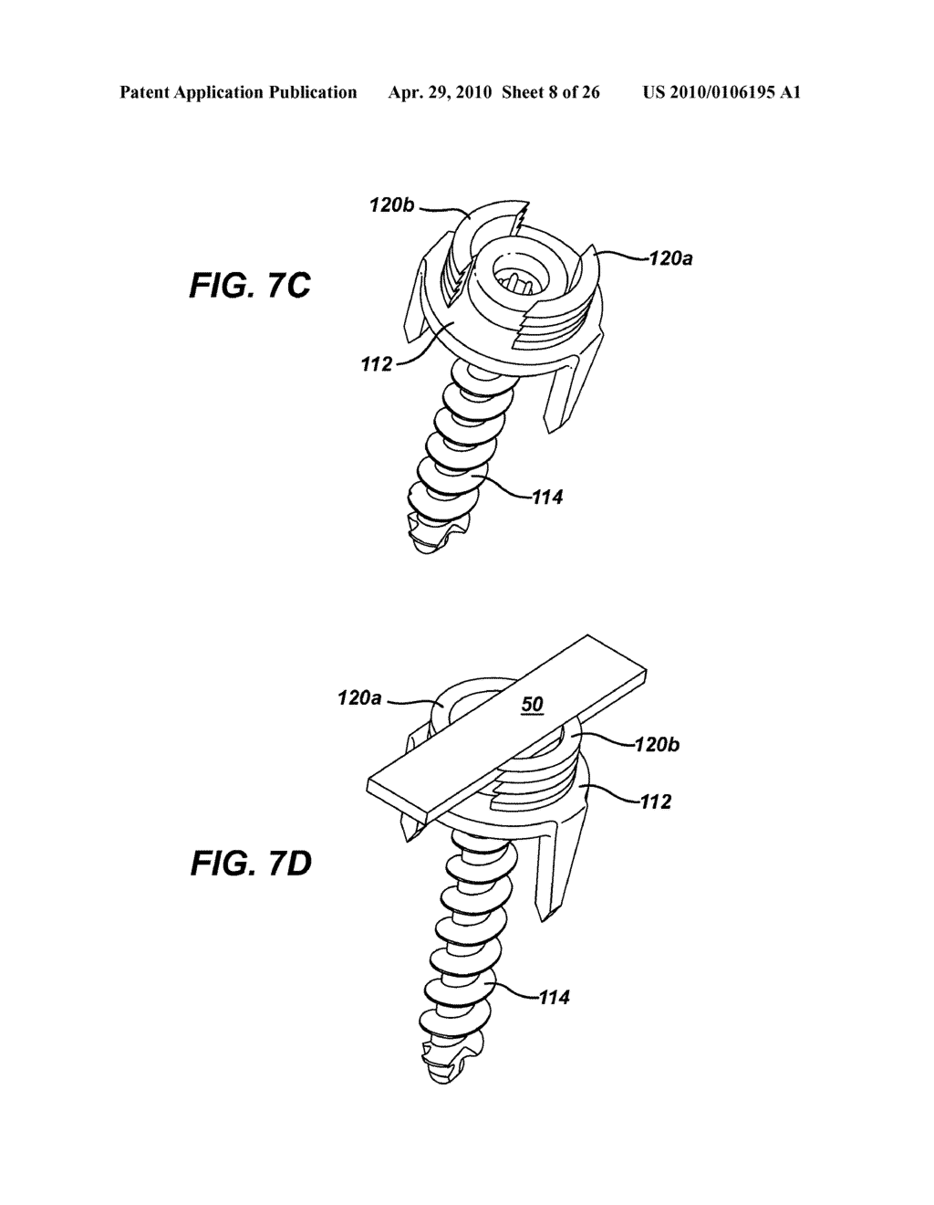 LOW PROFILE SPINAL TETHERING METHODS - diagram, schematic, and image 09