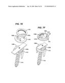 LOW PROFILE SPINAL TETHERING METHODS diagram and image