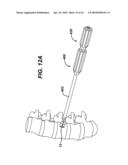 LOW PROFILE SPINAL TETHERING METHODS diagram and image