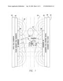 Systems and Methods for Exploiting the Tip or Ring Conductor of an Implantable Medical Device Lead During an MRI to Reduce Lead Heating and the Risks of MRI-Induced Stimulation diagram and image