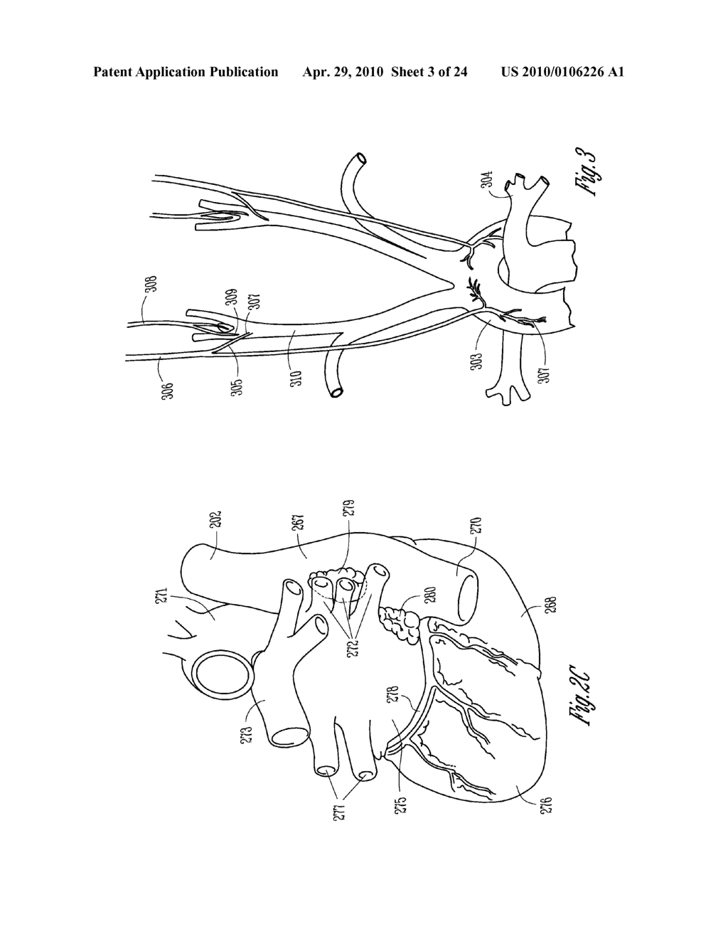 NEURAL STIMULATION MODULATION BASED ON MONITORED CARDIOVASCULAR PARAMETER - diagram, schematic, and image 04