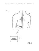 MEDICAL DEVICES AND METHODS FOR DELIVERY OF CURRENT-BASED ELECTRICAL STIMULATION THERAPY diagram and image