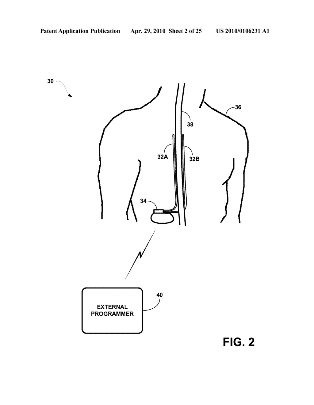 MEDICAL DEVICES AND METHODS FOR DELIVERY OF CURRENT-BASED ELECTRICAL STIMULATION THERAPY - diagram, schematic, and image 03