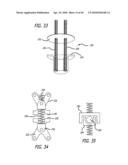 Extra-Articular Implantable Mechanical Energy Absorbing Systems diagram and image