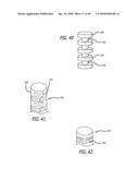 Extra-Articular Implantable Mechanical Energy Absorbing Systems diagram and image