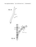 Extra-Articular Implantable Mechanical Energy Absorbing Systems diagram and image