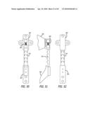 Extra-Articular Implantable Mechanical Energy Absorbing Systems diagram and image