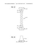 Extra-Articular Implantable Mechanical Energy Absorbing Systems diagram and image