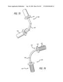 Extra-Articular Implantable Mechanical Energy Absorbing Systems diagram and image