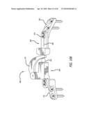 Extra-Articular Implantable Mechanical Energy Absorbing Systems diagram and image