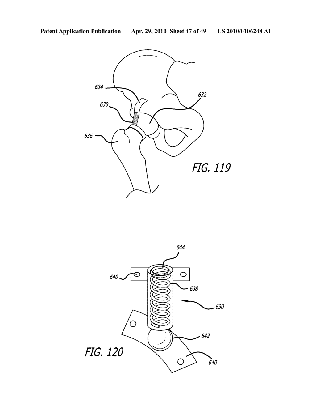 Extra-Articular Implantable Mechanical Energy Absorbing Systems - diagram, schematic, and image 48