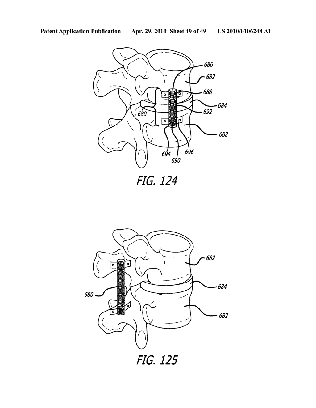 Extra-Articular Implantable Mechanical Energy Absorbing Systems - diagram, schematic, and image 50