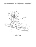 FOOT PROSTHESIS HAVING CUSHIONED ANKLE diagram and image