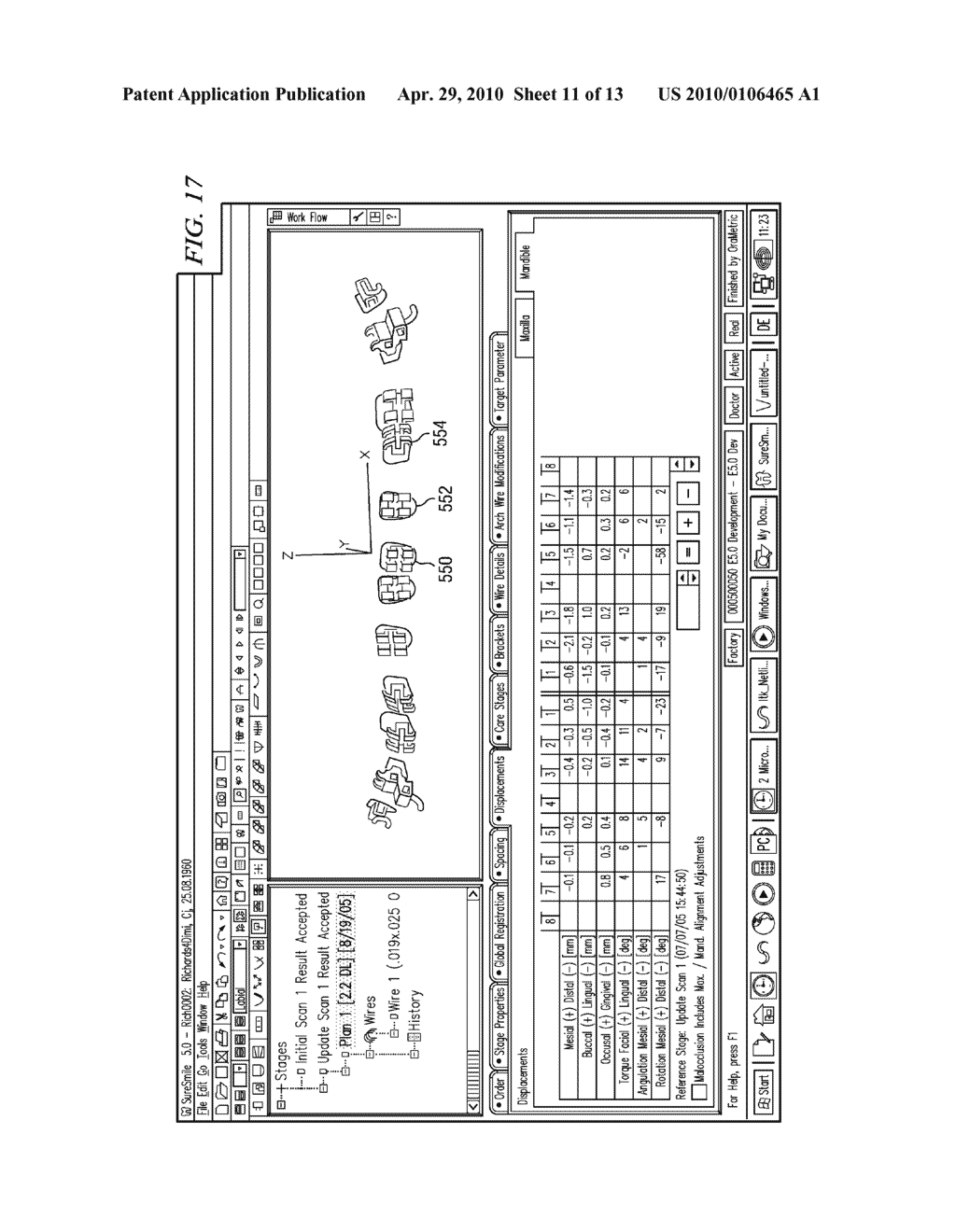 METHOD AND APPARATUS FOR DIGITALLY EVALUATING INSERTION QUALITY OF CUSTOMIZED ORTHODONTIC ARCH WIRE - diagram, schematic, and image 12