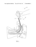 HAND OPERATED ARTICULATED INTUBATION STYLET diagram and image